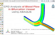 تحلیل CFD جریان خون در مجرای دوراهی رگ توسط آباکوس